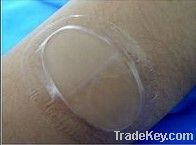 hydrogel medical wound dressing