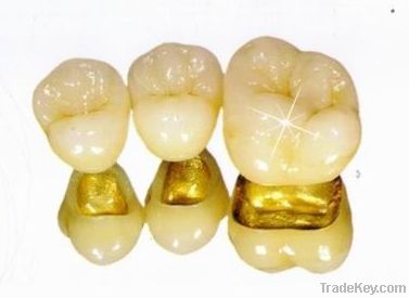 gold implant teeth