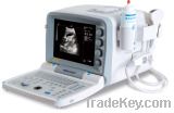 B Mode Ultrasound Scanner for Human Use (KX2000G)