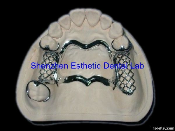 Dental metal partial framework