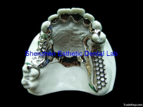 Dental metal partial framework