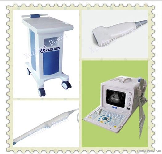 hot sale  Portable B-type ultrasonic diagnostic apparatushot sale for