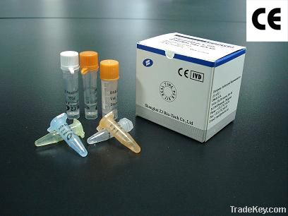 Dengue Virus General-type Real Time RT-PCR Kit