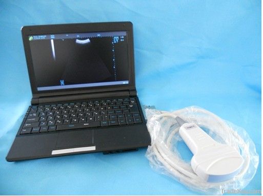 Full Digital Laptop Ultrasound Scanner