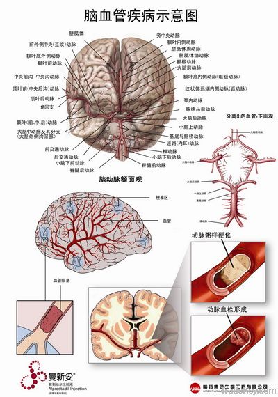 Two-sided 3D Medical Anatomical PVC Chart