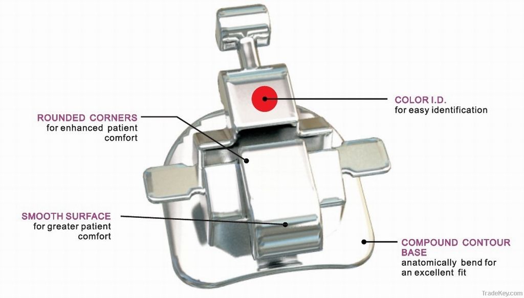 Orthodontic lingual system bracket brace