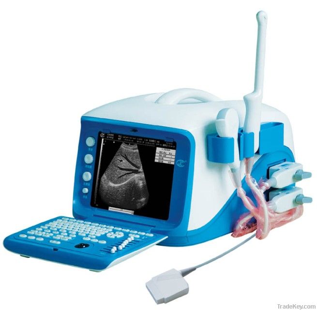 digital ultrasound scanner