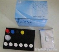 Rat Complement fragment 5a(C5A) ELISA Kit