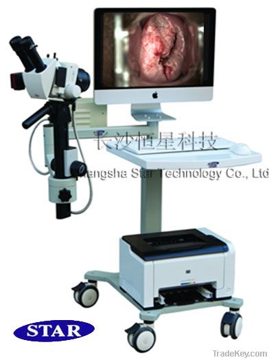 optic electronic colposcope