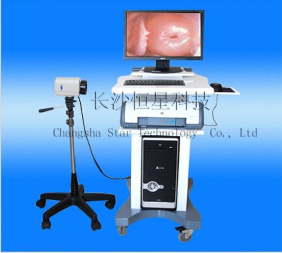 digital electronic colposcope