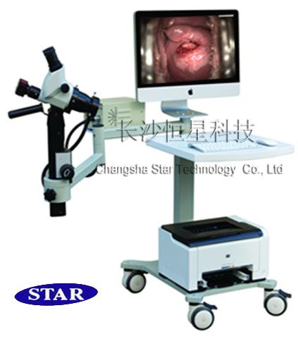 optic electronic colposcope