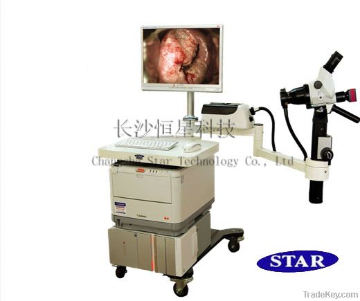 Optic Electronic Colposcope