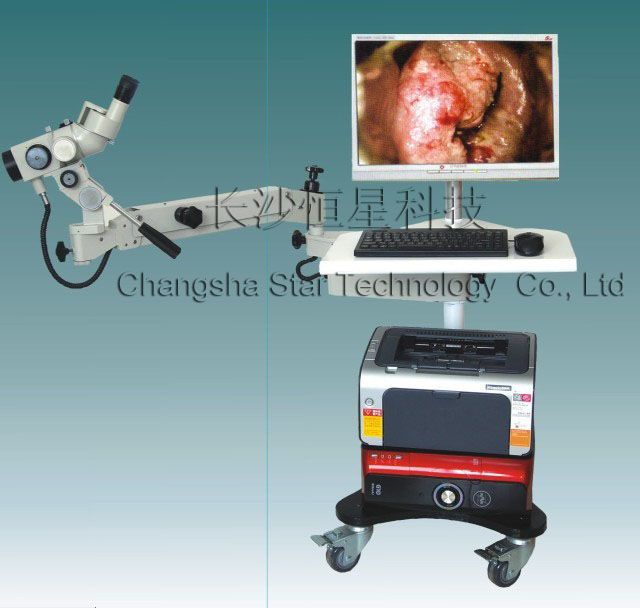 optic electronic colposcope