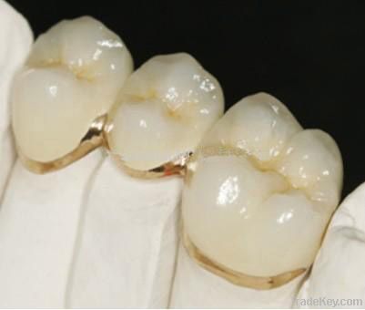 Dental Fixed Restoration PFM Crown/Bridge