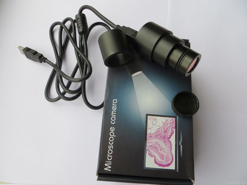 digital eyepiece