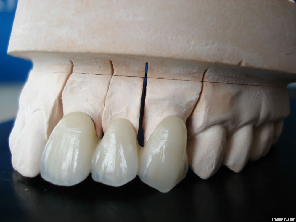 Cheap Dental Crown/Bridge