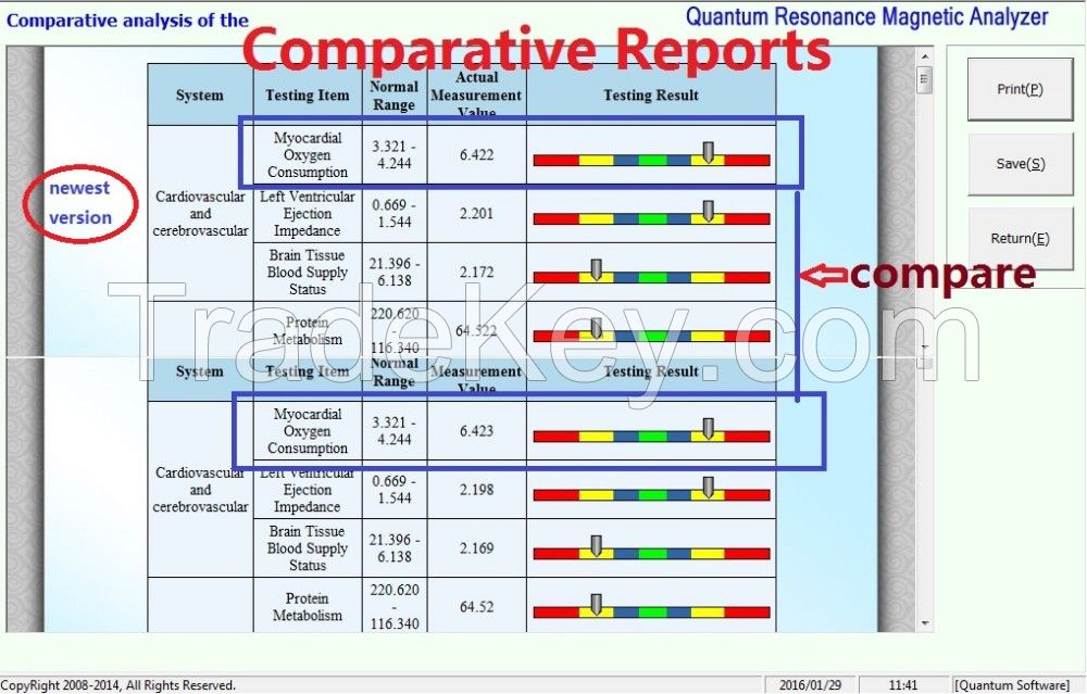 Newest 4th Generation 42 reports Quantum Magnetic Resonance Analyzer