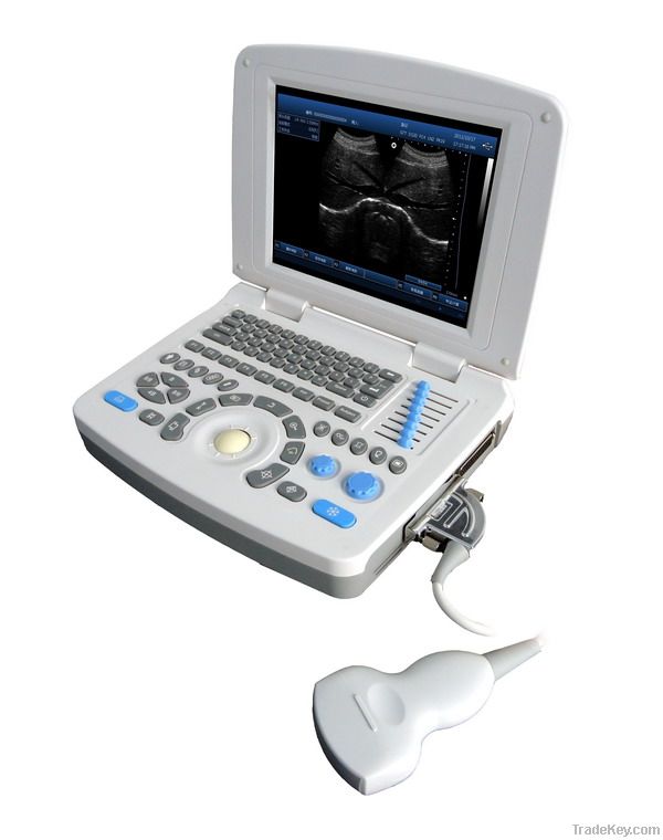 SS-10 Laptop PC Basic Ultrasound Scanner(3D image optional)