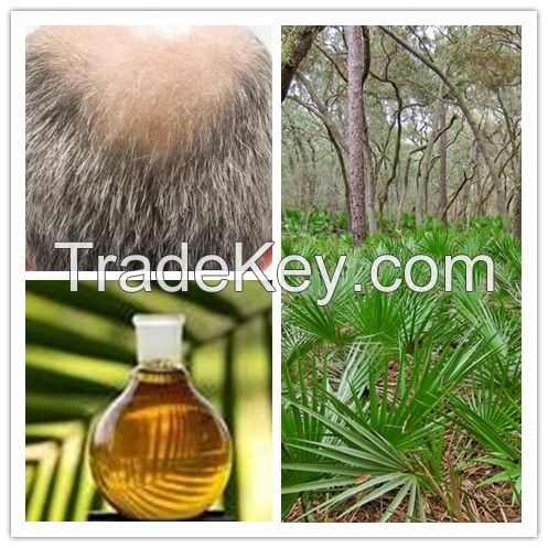 Saw palmetto extract