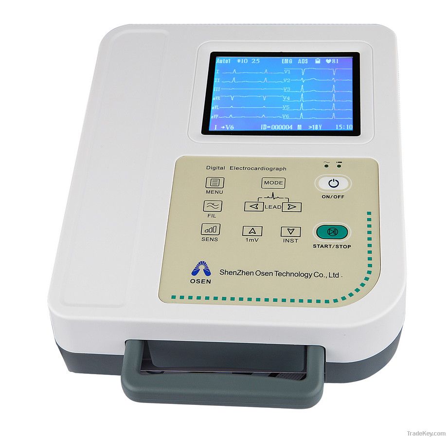 12 channel interpretive digital ECG