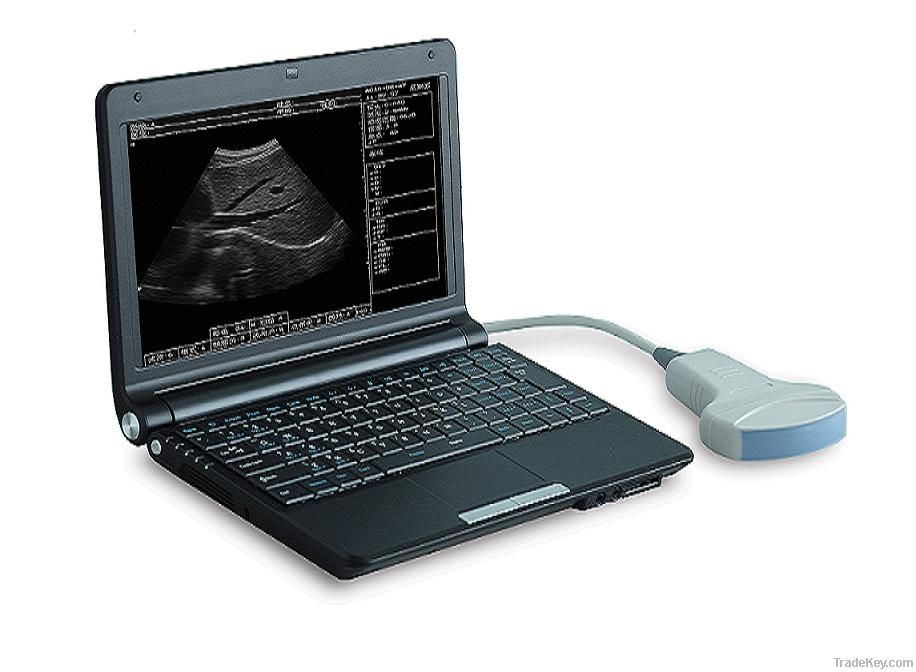 Laptop Ultrasound Scanner