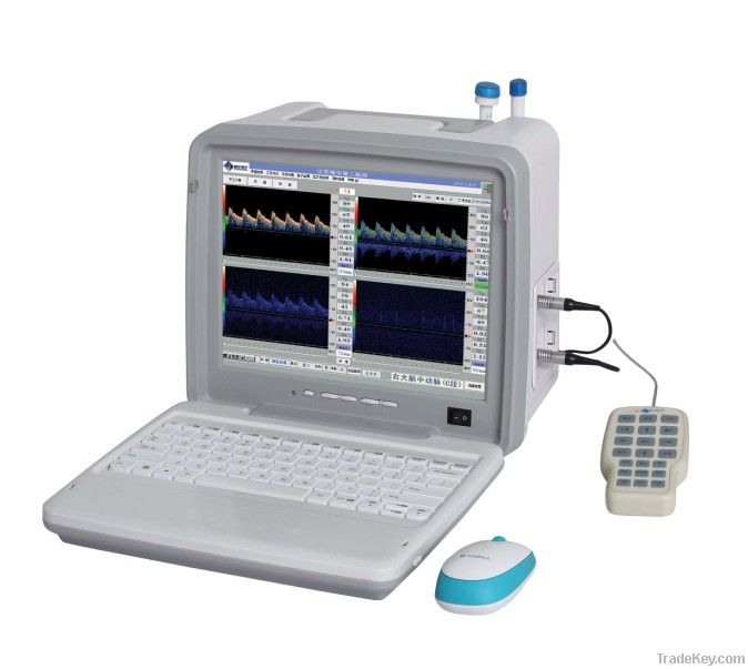 EXRH-3200E Portable Color Transcranial Doppler