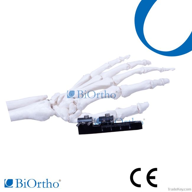 Orthofix Mini Fragment External Fixator Orthopedic Instruments