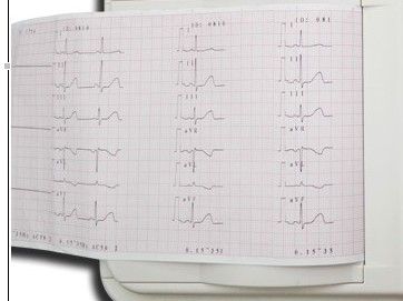 Color touch screen 6 channel ECG, ECG-8110