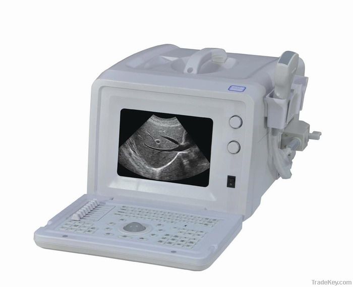 EXRH-300A Portable Ordinary Type Ultrasound Scanner