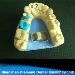 Dental Cocr PFM(porcelain-to metal) crowns