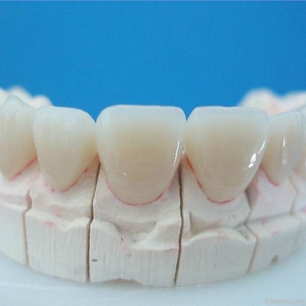 Dental IPS Empress Esthetic PFM Crown/Bridge