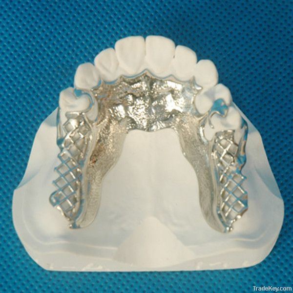 Dental Metal patial or full framework