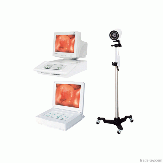 digital electronic colposcope