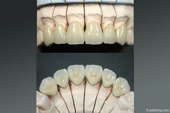 dental crown