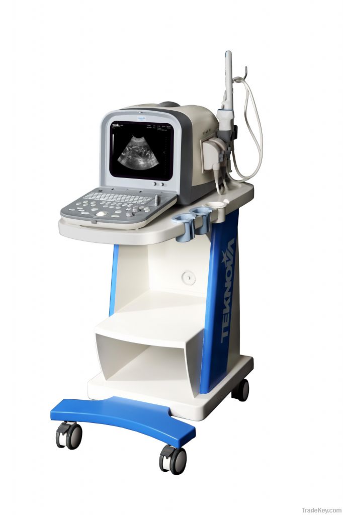 Full-digital Ultrasound Diagnostic System