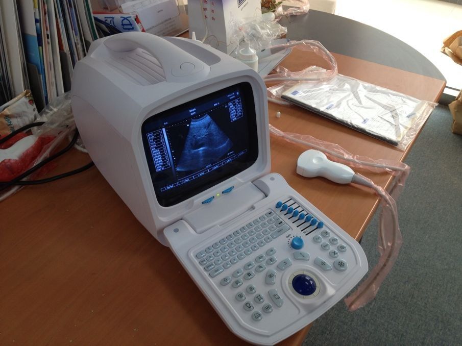 TH-100s Full-digital Ultrasound Diagnostic System