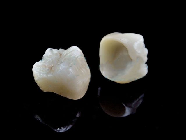 Denture (Crown&Bridge, Metal-Free,Full Milled Zirconia)