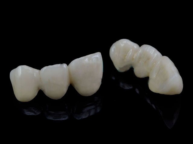 Denture (Crown&Bridge, Metal-Free,Cercon)