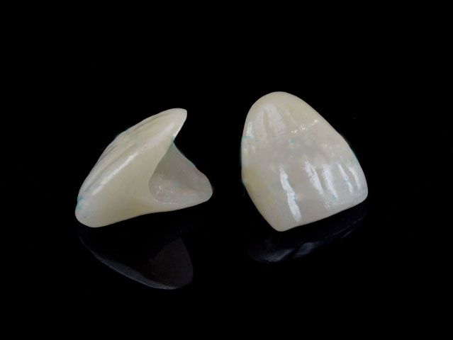 Denture (Metal-Free,VITABLOCS Crowns) Beauty & Health ÃÂ» Dental Products & Accessories