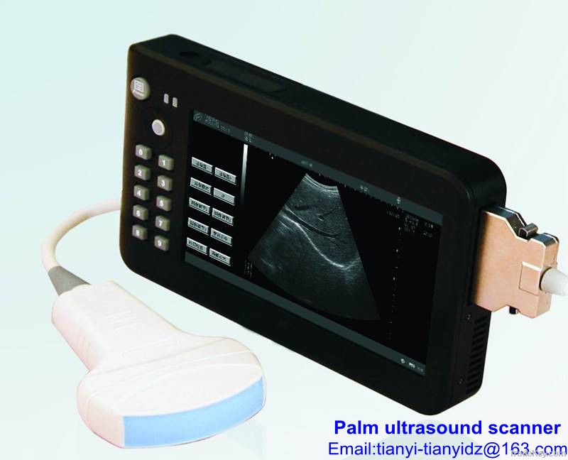 Palm/handheld ultrasound scanner