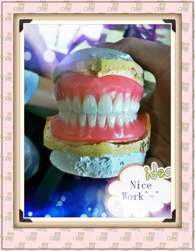 Full Denture wax try in