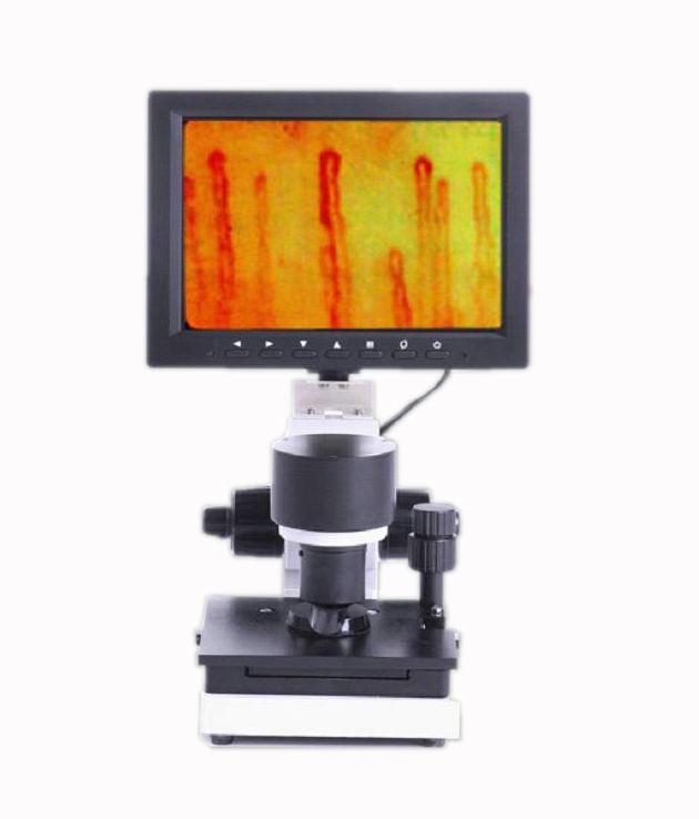 nail-fold microcirculation microscope