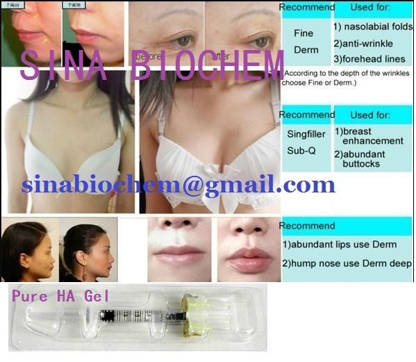 Deep Dermal Filler Hyaluronic Acid Gel HA gel