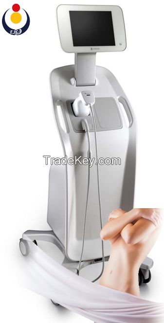 2016 hifu liposonix fat slimming machine used in body