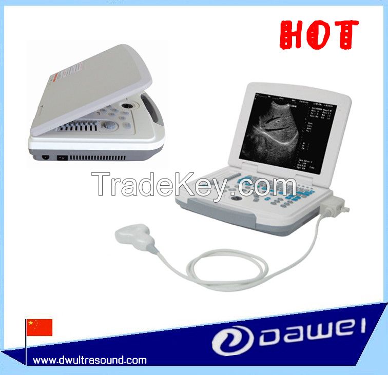 portable ultrasound scanner &amp; price laptop ultrasound machine