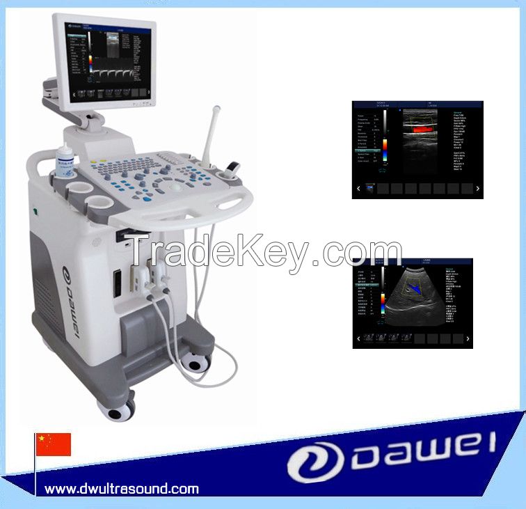 Trolley Color Doppler Ultrasound Machine &amp; Medical Ultrasound Equipment