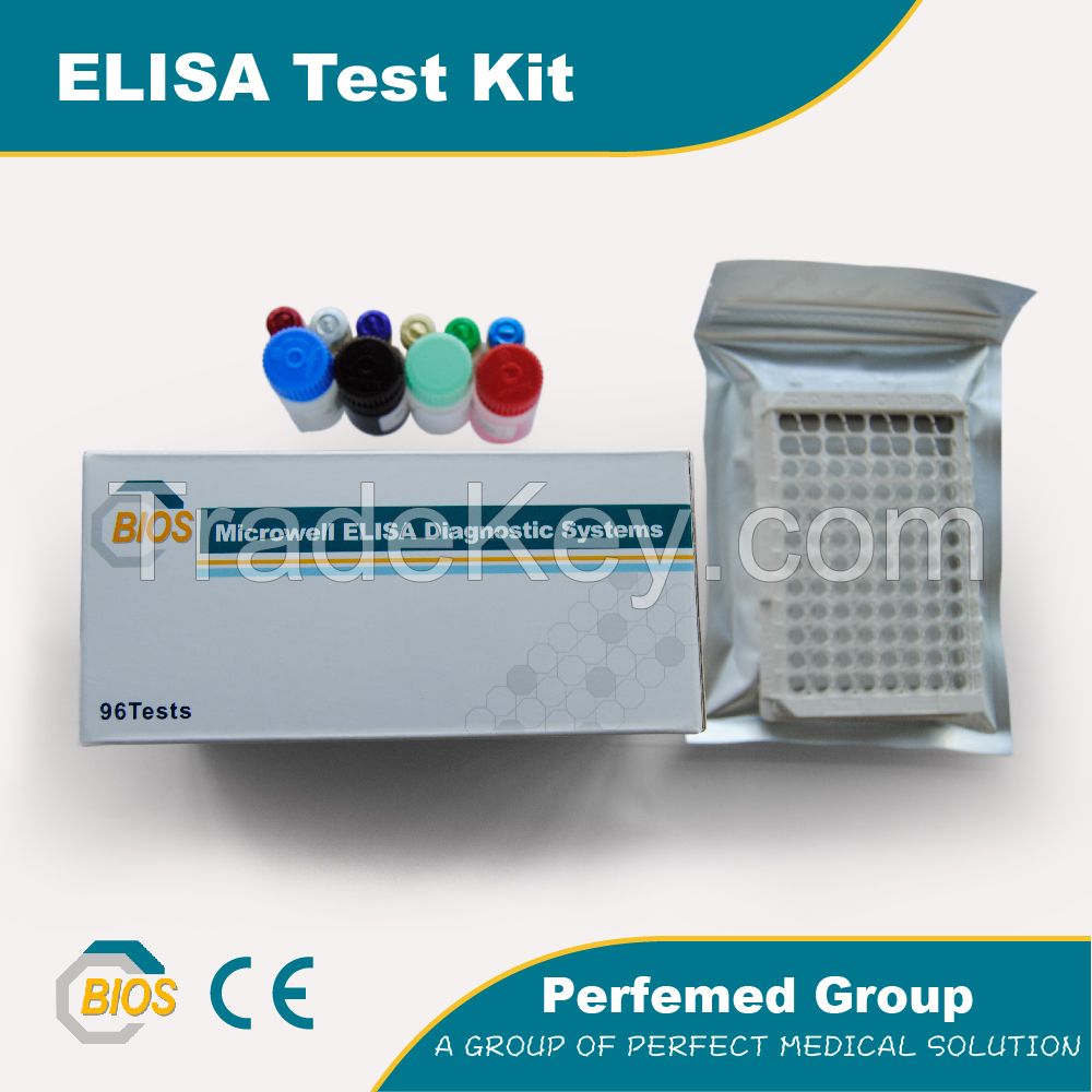 Thyroid Stimulating Hormone (U-TSH) ELISA Kit