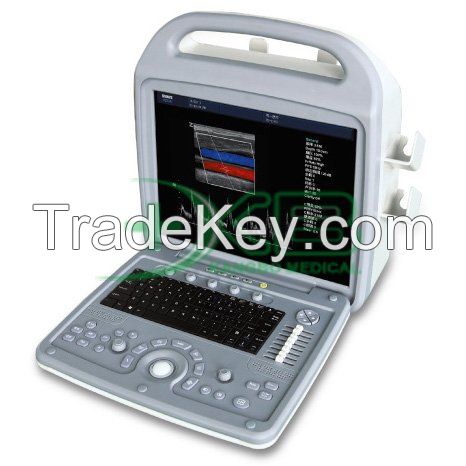 Full Digital Color Doppler Ultrasound KB-580