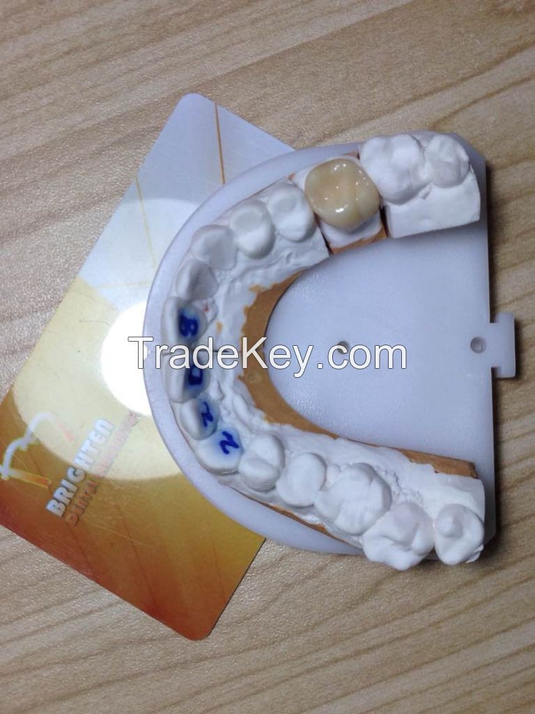 Dental Restoration  Sagemax Zirconia