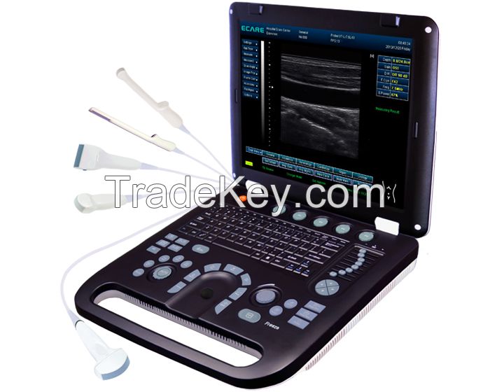 EC50A Laptop Ultrasound System